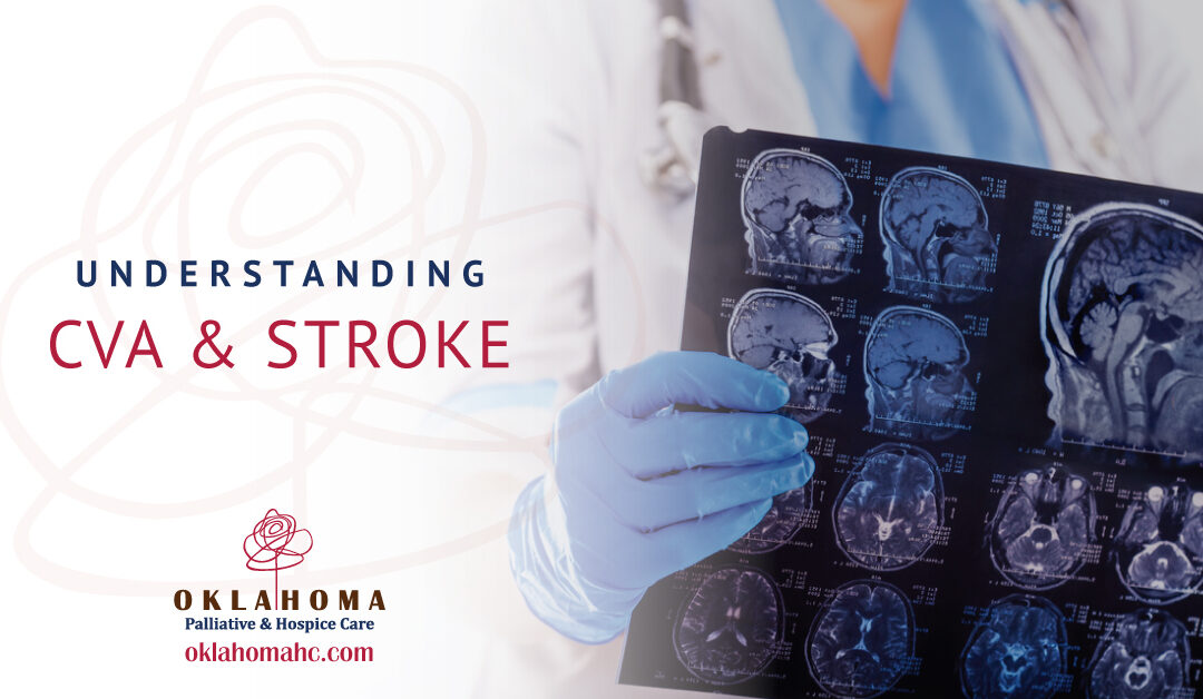 Understanding Cerebrovascular Accident (CVA) and Stroke